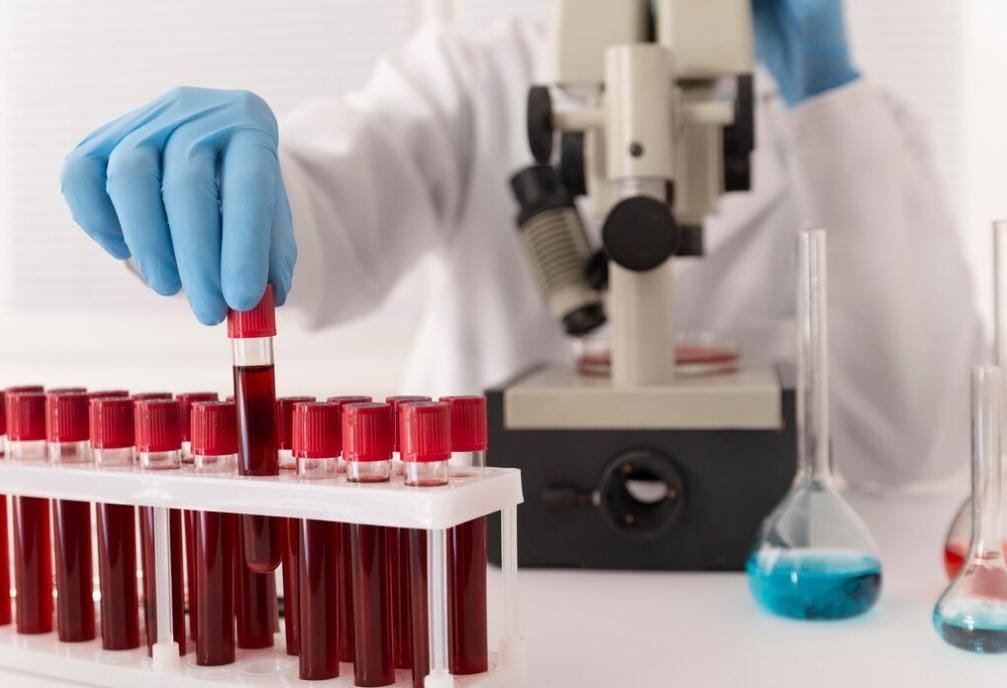 Fakta Golden Blood, Golongan Darah Paling Langka di Dunia